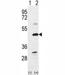 BMP7 Antibody