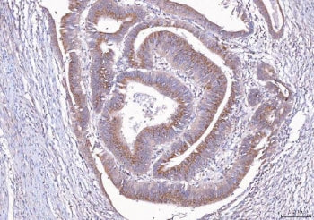 ALDH3A1 Antibody