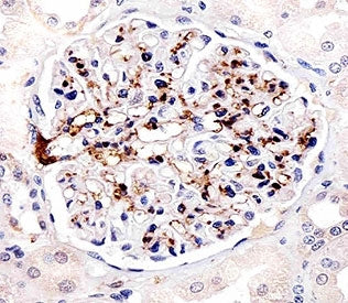 Immunohistochemical analysis of paraffin-embedded human kidney using FABP4 antibody at 1:25 dilution