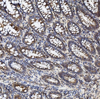 ZO2 Antibody / TJP2