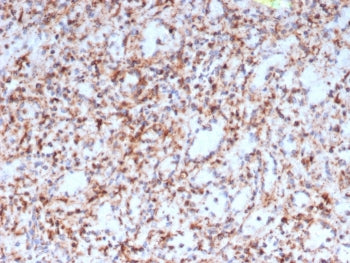 RETN Antibody / Resistin