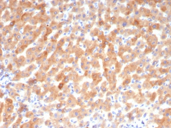 Transferrin Antibody