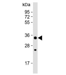 STUB1 Antibody