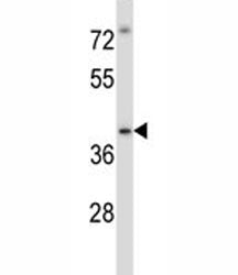 Irak4 Antibody