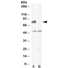 ZDHHC8 Antibody