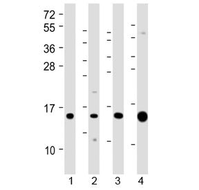 Western blot testing of 1) human kidney, 2) human Caki-1 (kidney-derived), 3) mouse Renca (kidney-de