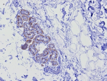 IHC staining of FFPE human skin tissue with recombinant Keratin 17 antibody (clone KRT17/8346R). HIE