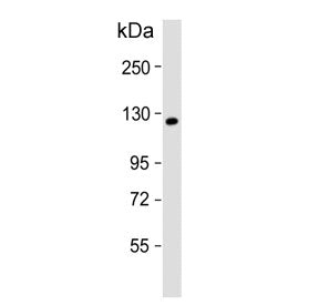Western blot testing of human A431 cell lysate with KIF11 antibody Predicted molecular weight ~119 k