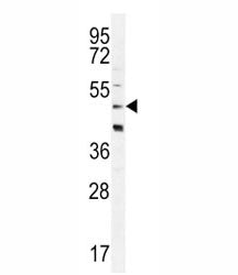 CRFR2D Antibody