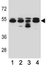 Tubulin beta 8 Antibody (TUBB8)