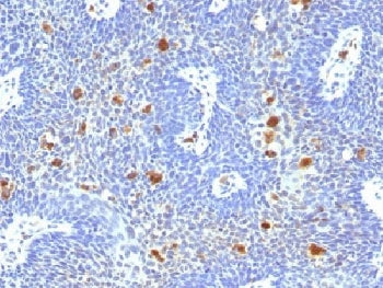 HPV-16 E6 Antibody