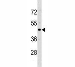 CCR5 Antibody