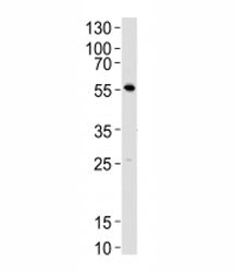 Lck Antibody