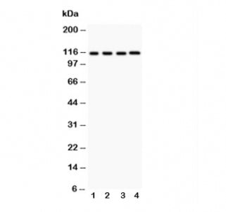 Western blot testing of NALP3 antibody and lysates from the human tumor cell lines 1: HeLa; 2: MCF-7