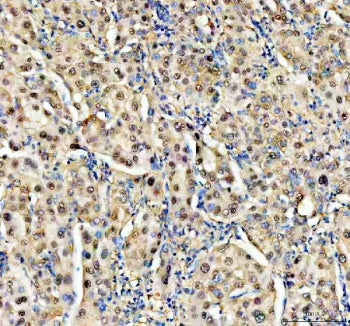 NUDT5 Antibody / ADP-sugar pyrophosphatase
