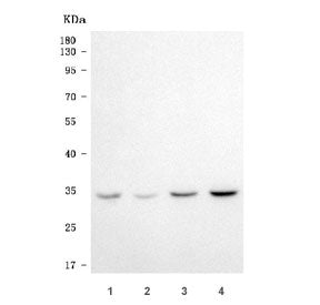 Elongation factor Ts Antibody / EF-Ts / TSFM