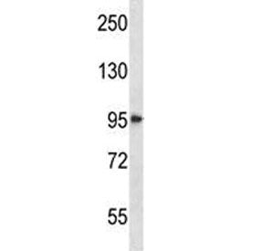 HDAC4 Antibody