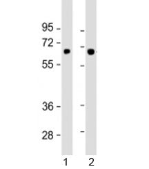 SLC5A8 Antibody / Sodium-coupled monocarboxylate transporter 1