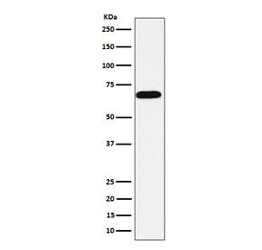 Intestinal Alkaline Phosphatase Antibody / ALPI
