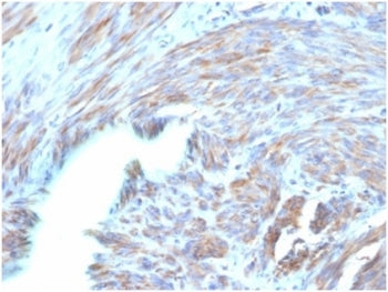 IHC staining of FFPE human uterus with BNP antibody (clone NPPB/4493). HIER: boil tissue sections in