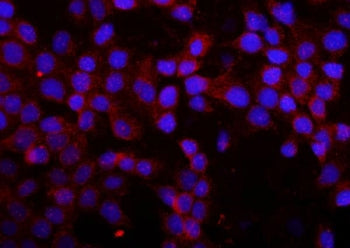 MMP16 Antibody