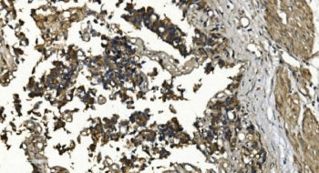 RGS6 Antibody