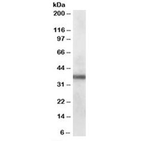 PDLIM1 Antibody