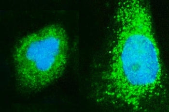 Immunofluorescent staining of FFPE human A431 cells with ADP-ribosylation factor 6 antibody (green) and DAPI nuclear stain (blue). HIER: steam section in pH6 citrate buffer for 20 min.