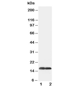 Western blot testing of SOD1 antibody and Lane 1: COLO320; 2: SMMC-7721 cell lysate. Predicted molec