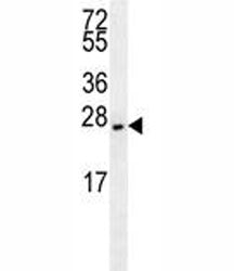 EIF4E2 Antibody