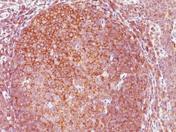 IHC staining of FFPE human tonsil with Bcl10 antibody (clone 151). HIER: boil tissue sections in pH 