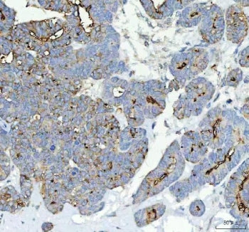 Alkaline Phosphatase Antibody (tissue-nonspecific)