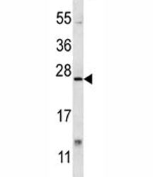XBP1 antibody western blot analysis in mouse lung tissue lysate. Predicted molecular weight: ~29 kDa