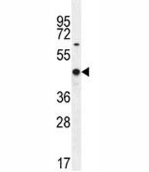 WT1 Antibody (Wilms Tumor protein)