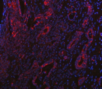 BCAT2 Antibody / PP18