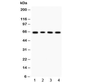 LBP Antibody (Lipopolysaccharide binding protein)