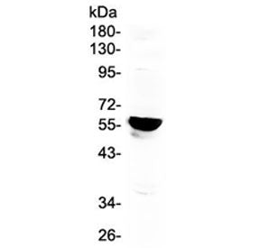 Aromatase Antibody / CYP19A1