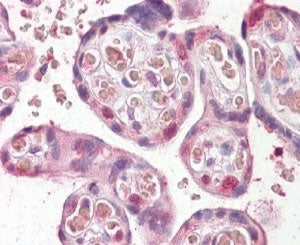 FANCE Antibody