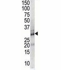 DSCR1 Antibody