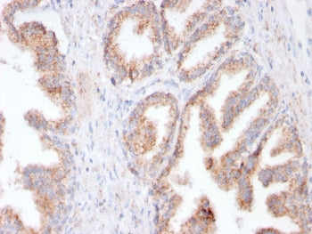 Folate Hydrolase 1 Antibody / FOLH1 / PSMA