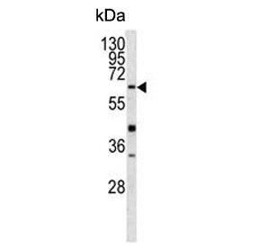 Glutathione hydrolase 5 proenzyme Antibody / GGT5 / GGTLA1