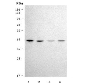 Western blot testing of human 1) 293T, 2) Jurkat, 3) A549 and 4) HeLa cell lysate with TRNAU1AP anti