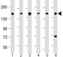 PDS5B Antibody