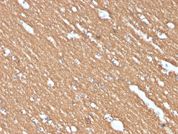 IHC staining of FFPE human brain with Myelin Basic Protein antibody (clone MBP/4274). HIER: boil tis