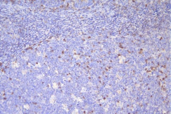 IHC staining of FFPE human tonsil with CD79a antibody. HIER: boil tissue sections in pH6, 10mM citra