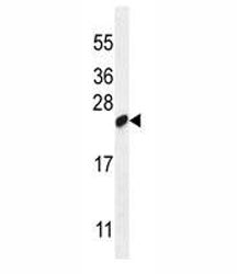 LOC147646 Antibody