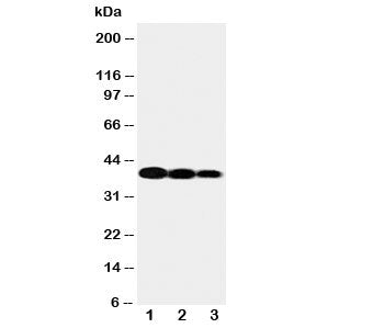 IL12 p40 Antibody