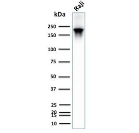 Western blot testing of recombinant CD45RB antibody and human Raji lysate. Expected molecular weight