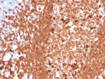 IHC staining of FFPE human tonsil with recombinant CD79a antibody (clone IGA/3939R). HIER: boil tiss