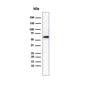 Western blot testing of human heart tissue lysate using Phosphoglucomutase 5 antibody (clone PGM5/35